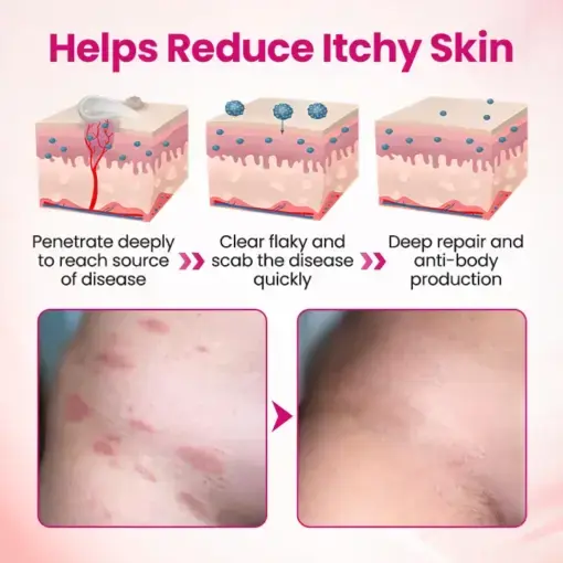 IntiDefend Anti-HPV Interferon Gel