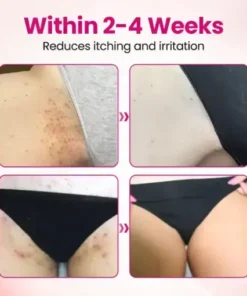 IntiDefend Anti-HPV Interferon Gel