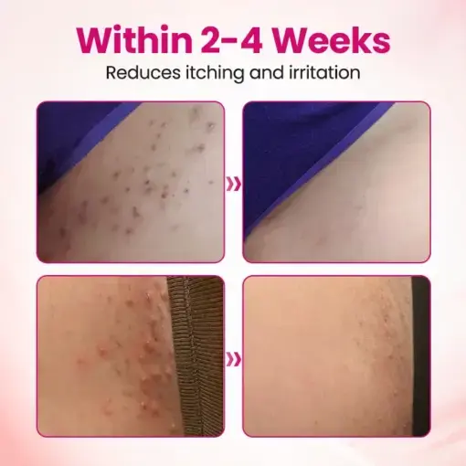 IntiDefend Anti-HPV Interferon Gel