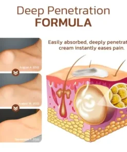 Lumpless Lipoma Treatment Cream