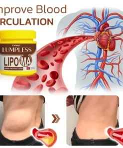 Lumpless Lipoma Treatment Cream