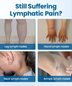 Lymphora Swelling Relief Roll-On