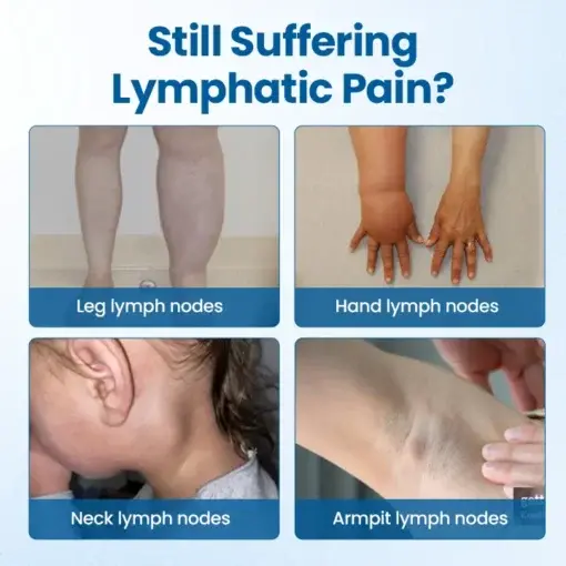 Lymphora Swelling Relief Roll-On