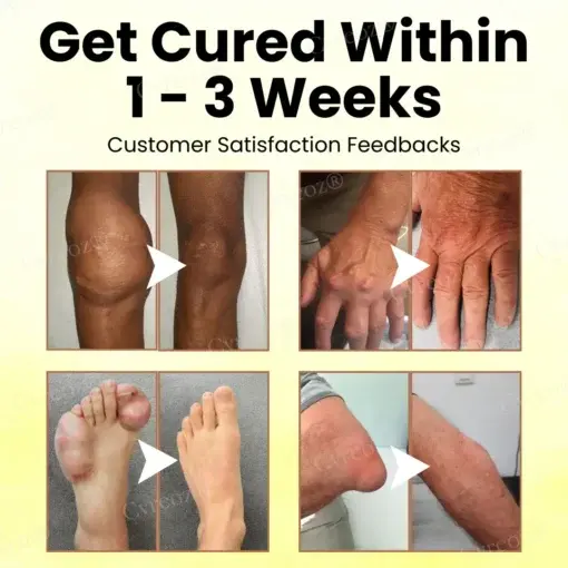 Magnesium Oil & Bee Venom Joint Healing Spray