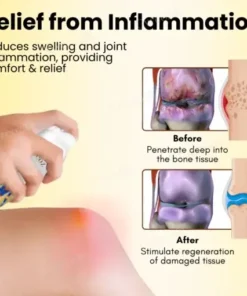 Magnesium Oil & Bee Venom Joint Healing Spray