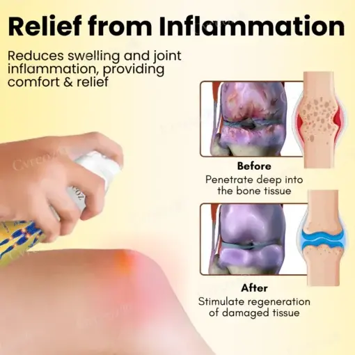 Magnesium Oil & Bee Venom Joint Healing Spray