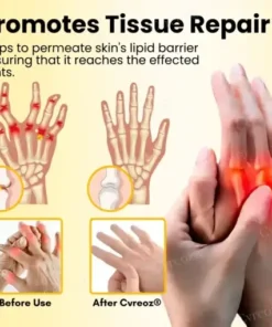 Magnesium Oil & Bee Venom Joint Healing Spray