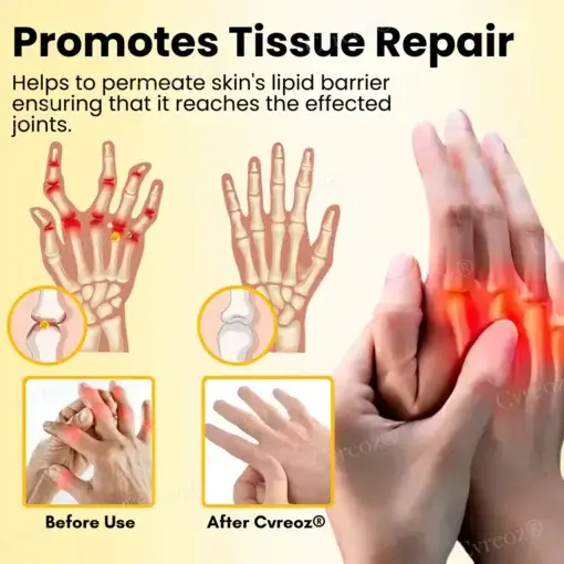 Magnesium Oil & Bee Venom Joint Healing Spray