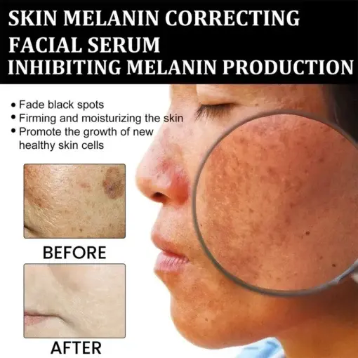 Melanin Correcting Facial Serum