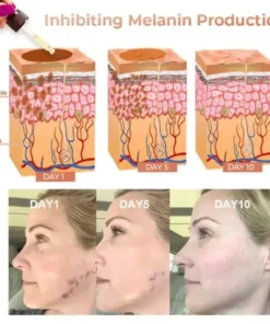 Melanin Correcting Facial Serum