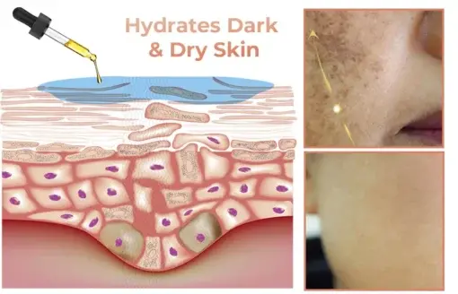 Melanin Correcting Facial Serum