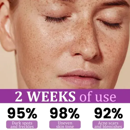 MelantraX Advanced Anti-Hyperpigmentation Essence