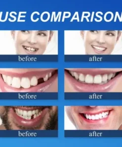 NESLEMY™ –Advanced Customized Full Denture Set