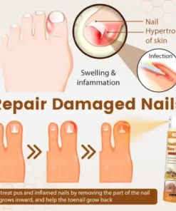 NailRescue Bee Venom Spray