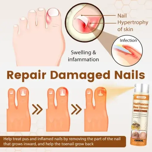 NailRescue Bee Venom Spray