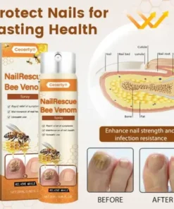 NailRescue Bee Venom Spray