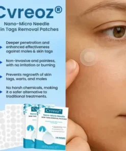 Nano-Micro Needle Skin Tags Removal Patches