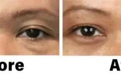 Nano Vision Repair Eye Serum