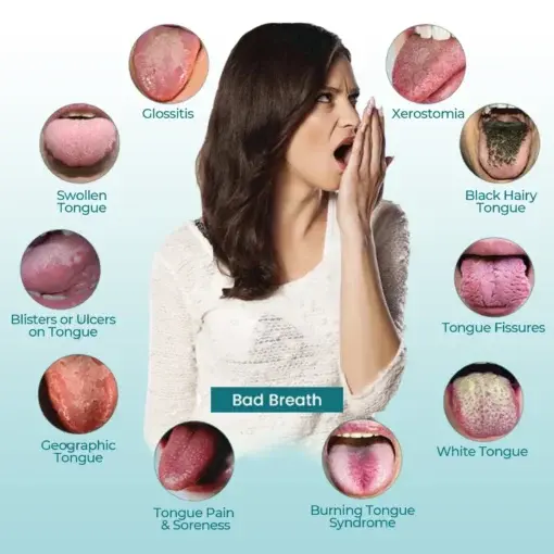 OralGuard Tongue Repair Spray