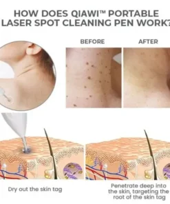 Portable Laser Spot Cleaning Pen