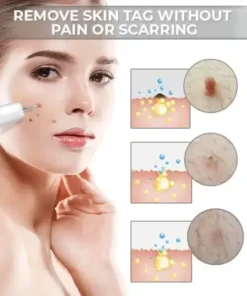 Portable Laser Spot Cleaning Pen