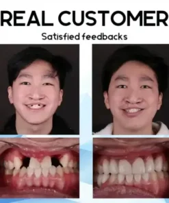 Premium Custom Silicone Denture Set