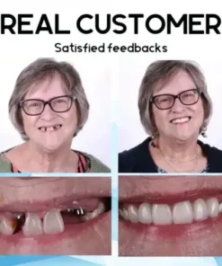 Premium Customised Silicone Denture Kit