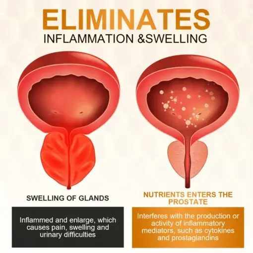 ProstaFlow Rapid Relief Nasal Spray