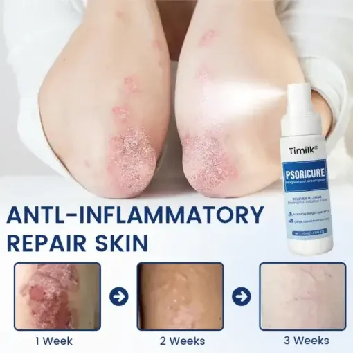 PsoriCure Magnesium Herbal Spray