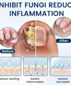 PsoriCure Magnesium Herbal Spray