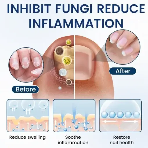 PsoriCure Magnesium Herbal Spray