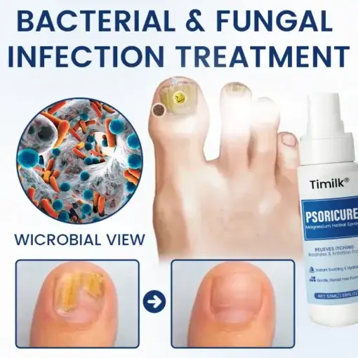 PsoriCure Magnesium Herbal Spray