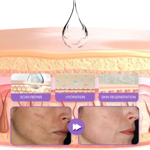 RevivaDerma Face & Body Scar Gel