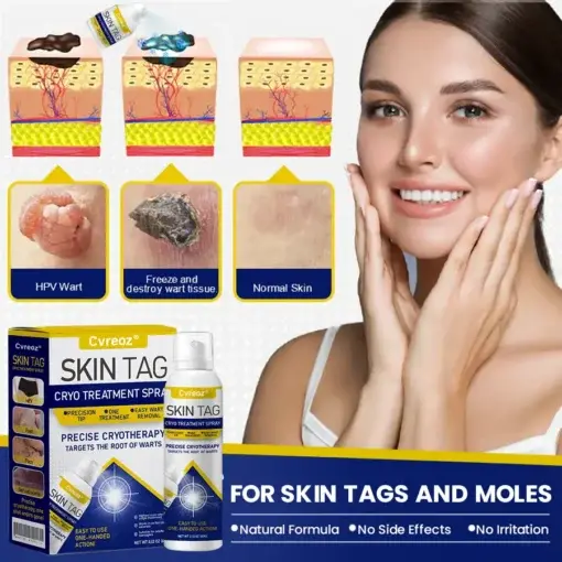 Skin Tag Cryo Treatment Spray