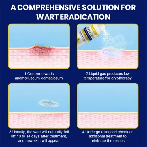 Skin Tag Cryo Treatment Spray