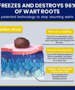 Skin Tag Cryo Treatment Spray