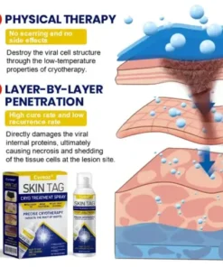Skin Tag Cryo Treatment Spray