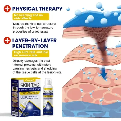 Skin Tag Cryo Treatment Spray