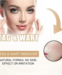 Skin Tag & Mole Remover