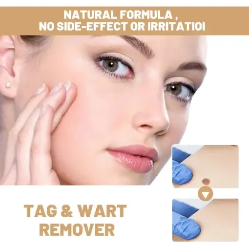 Skin Tag & Mole Remover