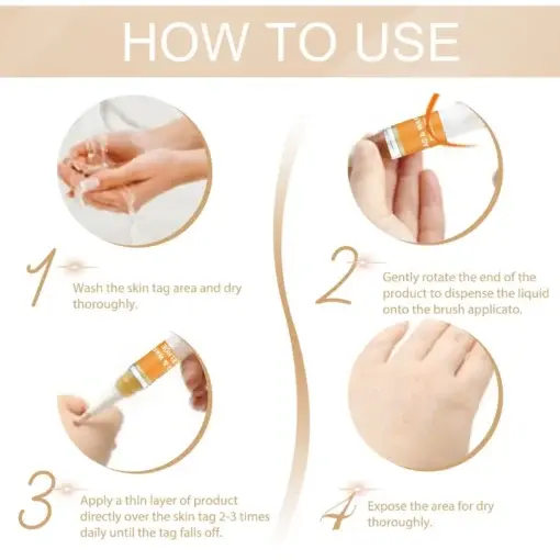 Skin Tag & Mole Remover