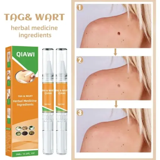 Skin Tag & Mole Remover