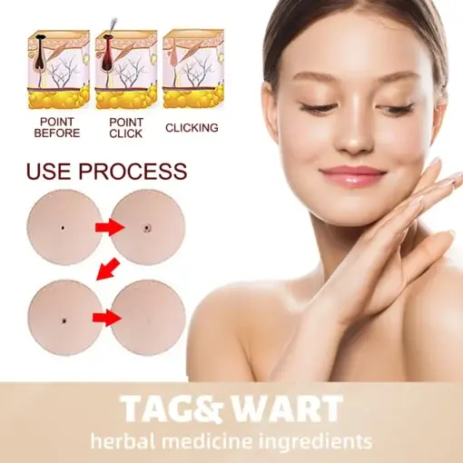 Skin Tag & Mole Remover