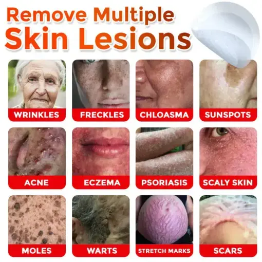 Skin Tag Removal Patch