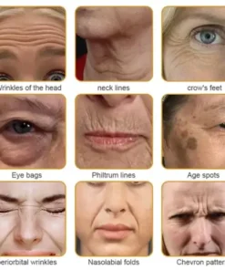 Skin Treatment Cream