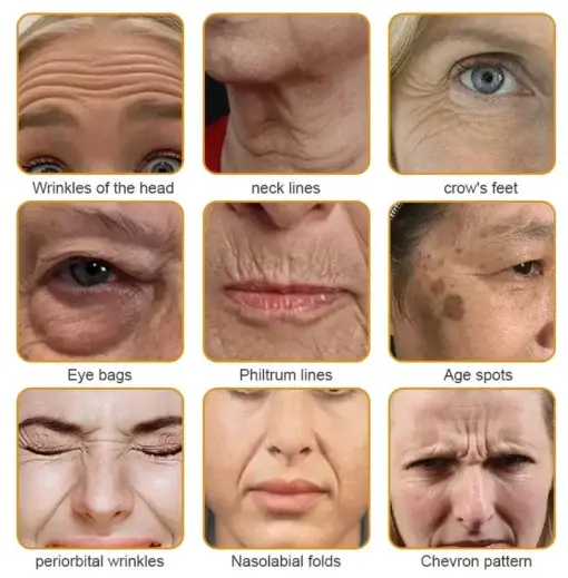 Skin Treatment Cream