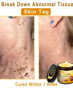 Skin Treatment Cream