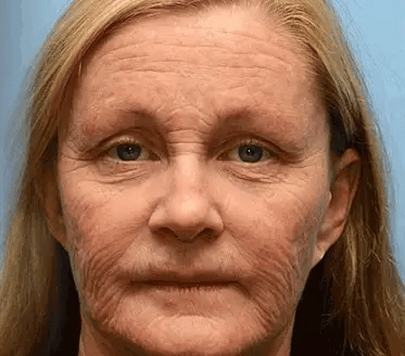 Skin Treatment Cream