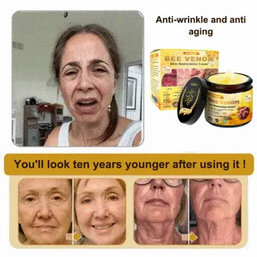 Skin Treatment Cream