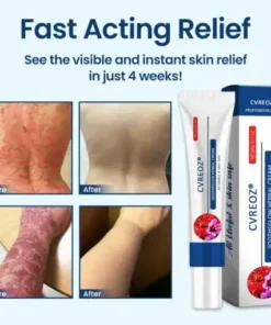 SootheGlow Herbal Cream